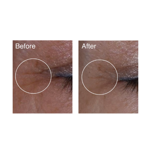 Befor-After-Serum-Zombie-Cell-Prescription