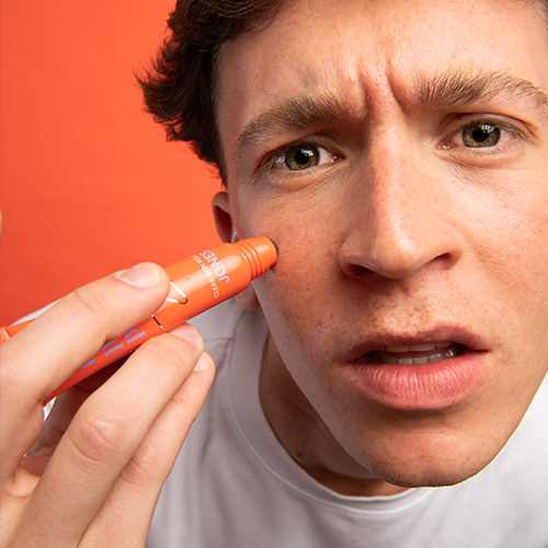 anti-blemish-roller-tegen-puistjes-en-irritatie