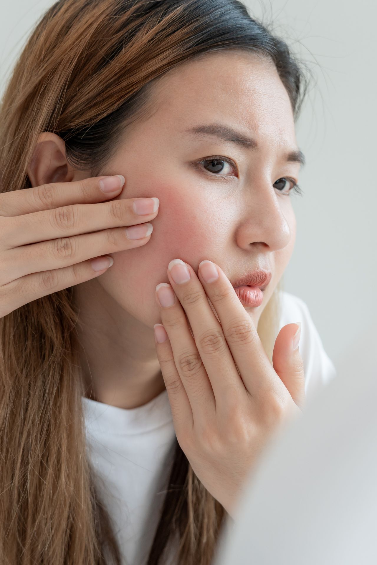 Vrouw met rosacea