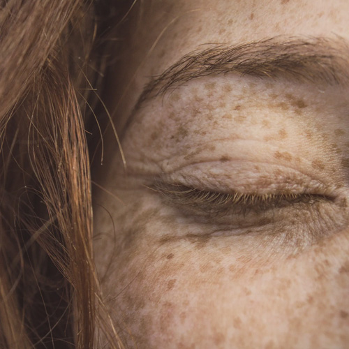Donkere vlekken en een ongelijkmatige teint: de ideale huidverzorgingsroutine voor een huid met pigmentatie