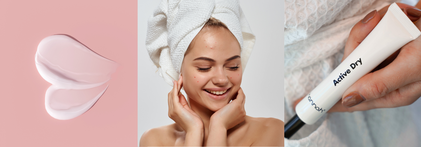 Spot Treatments